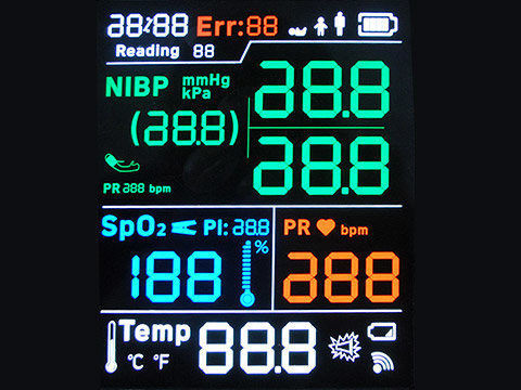 STN YG ST7565R 7 Segment LCD Screen Monochrome 128X64 Dots FPC Soldering