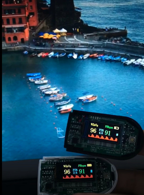 0.96'' Tft Lcd Display 4W SPI 80×160 Dots 13 Pin Nv3022b FSTN Transmissive