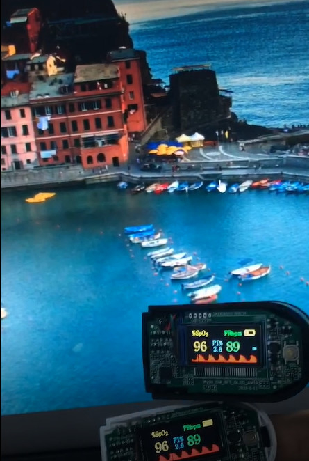 0.96'' Tft Lcd Display 4W SPI 80×160 Dots 13 Pin Nv3022b FSTN Transmissive