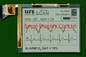 320*240 FSTN LCD Module Monochrome For Medical Scan Positive